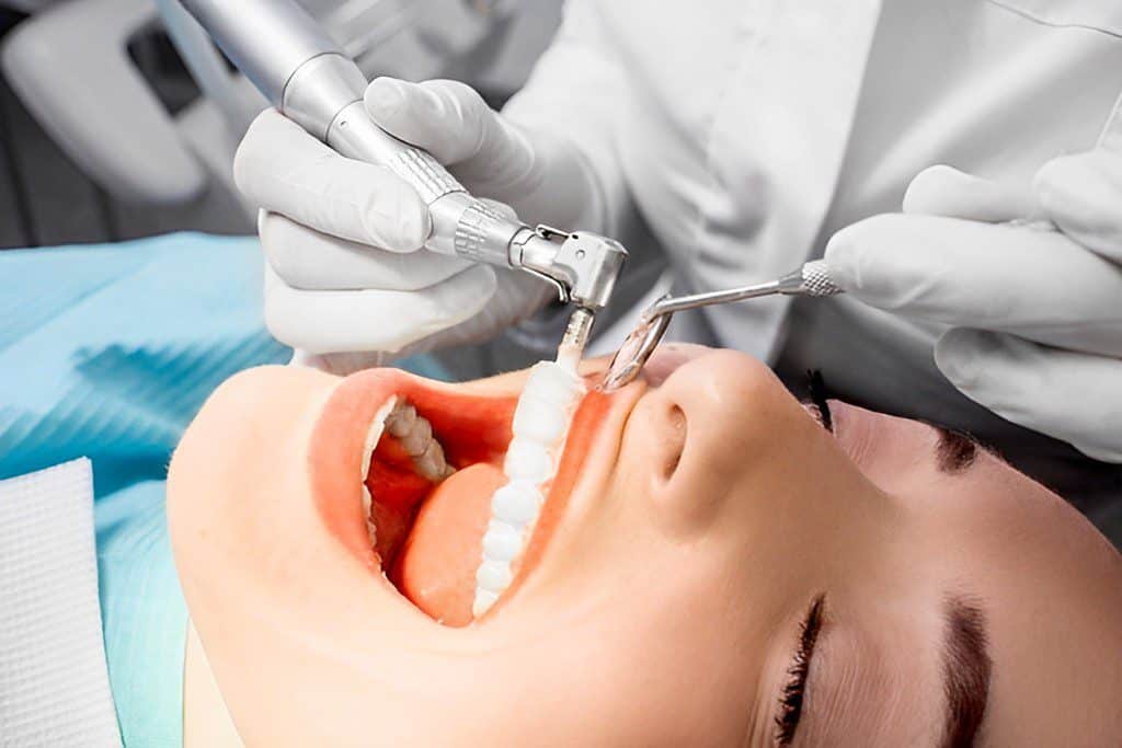 Teeth Cleaning - ismile dental clinic